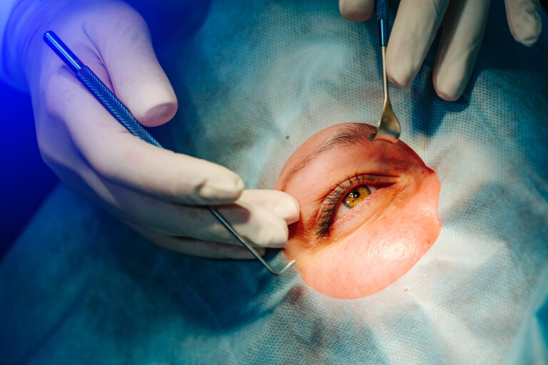 Types of Cataract Surgery: Understanding Your Options