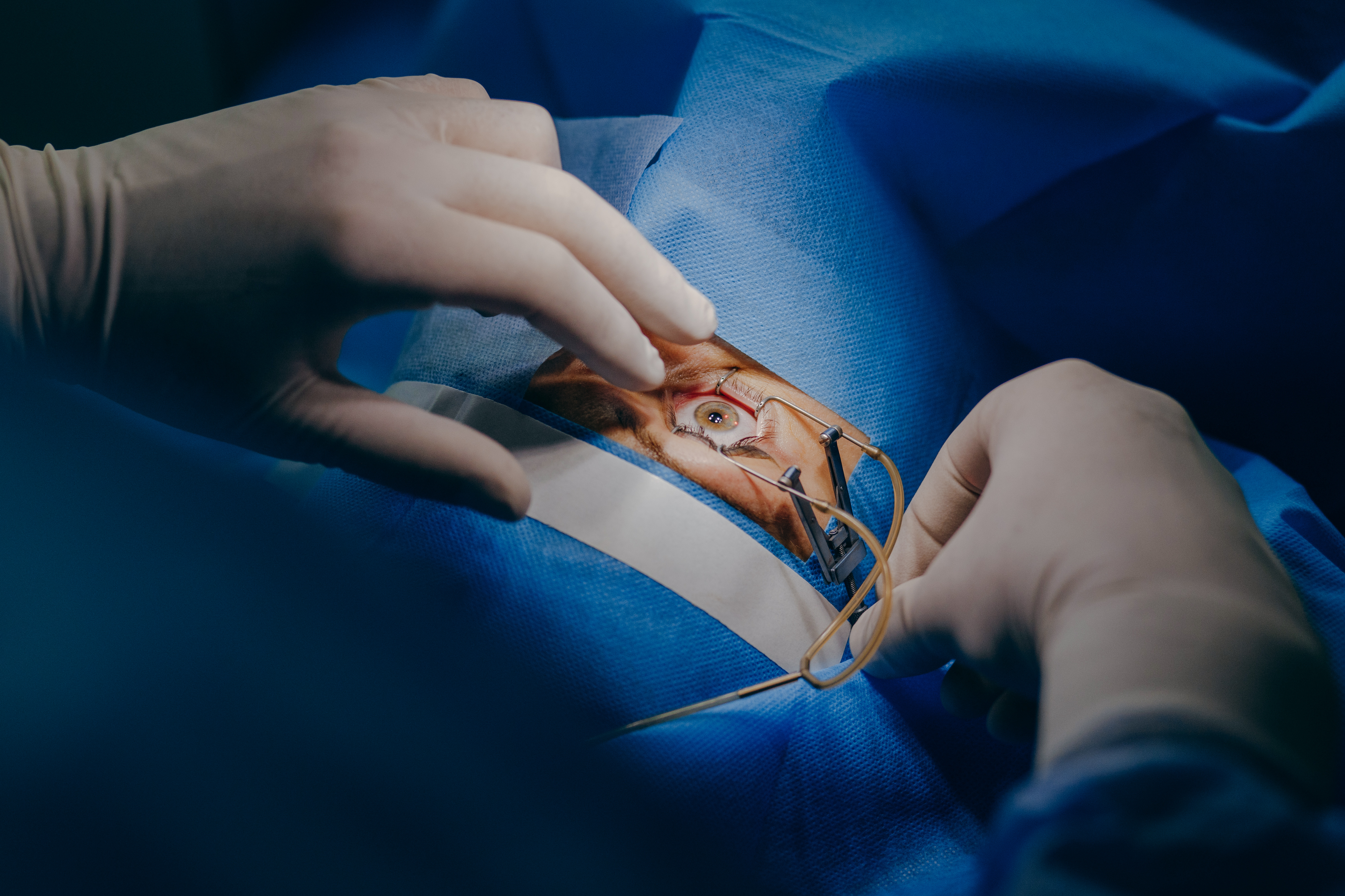 Understanding LASIK Eye Surgery Cost in India: What You Need to Know