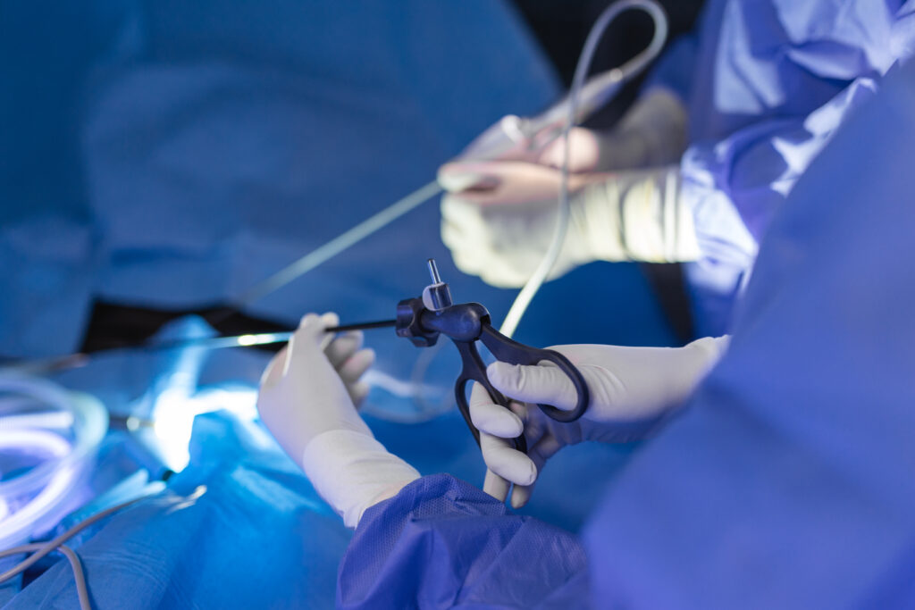 Gynecology laparoscopy