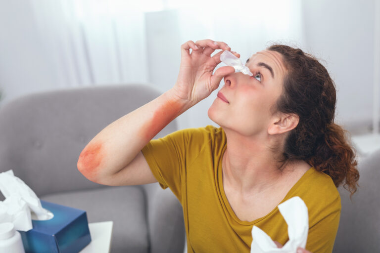 Ultimate Guide to Eye Allergy Treatment: Causes, Symptoms & Relief Options