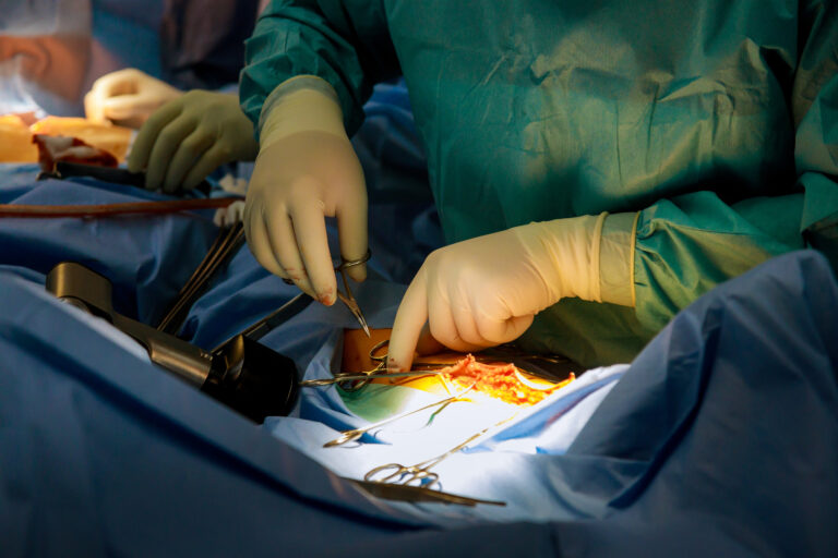 Everything You Need to Know About Hernia Repair with Mesh