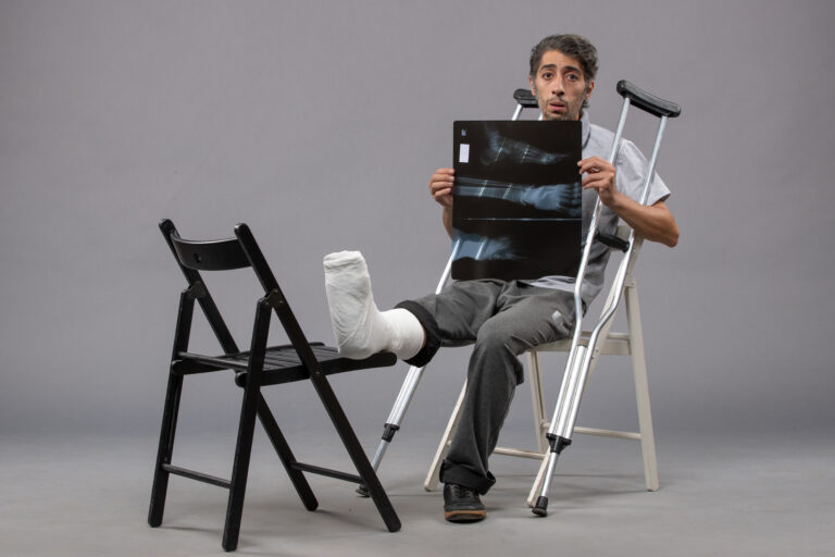 Comprehensive Guide to Fracture and Trauma Care: Healing Bones, Restoring Lives