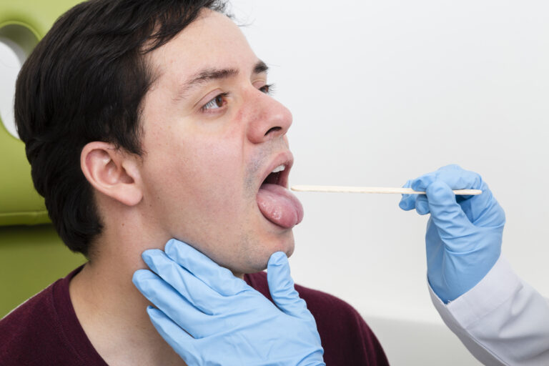 Tonsillitis Treatment: A Complete Guide to Symptoms, Causes, and Recovery
