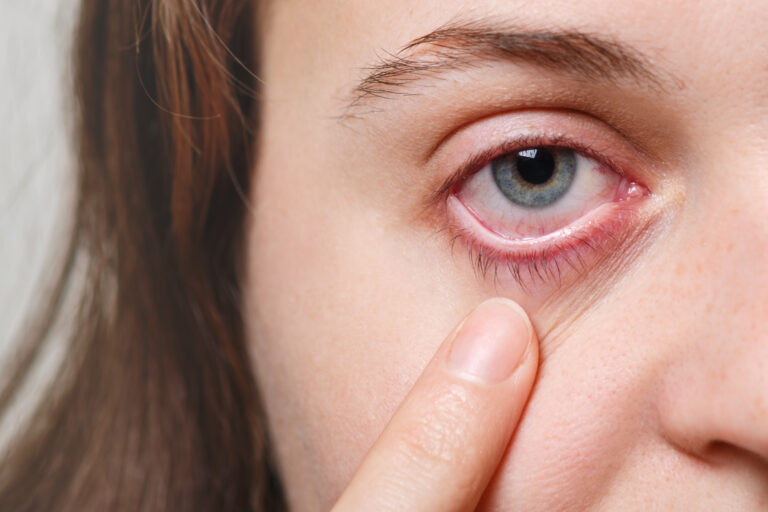 Eye Infection Symptoms: A Simple Guide to Protect Your Vision